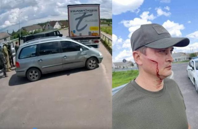 Поблизу Ковеля чоловік вдарив працівника ТЦК лопатою